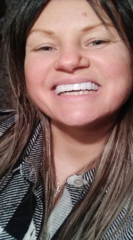 Snap On False Teeth Upper + Lower Dental Instant Veneers Dentures Tooth Cover White | Natural Look photo review
